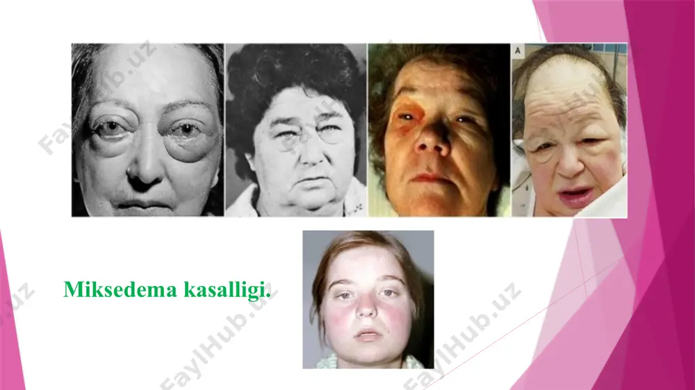 ichkisekretsiya bezlari va ularning gormonlari - Page 5