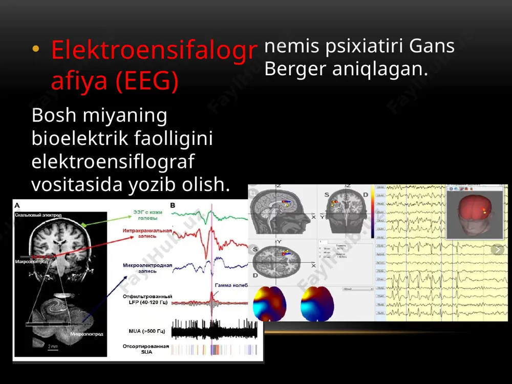 kalla-suyagi, bosh miya nur tekshiruv usullari. markaziy nerv tizimi kasalliklari - Page 5