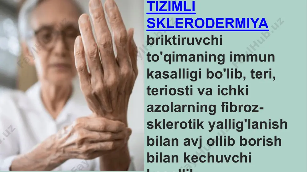 tizimli sklerodermiya - Page 2