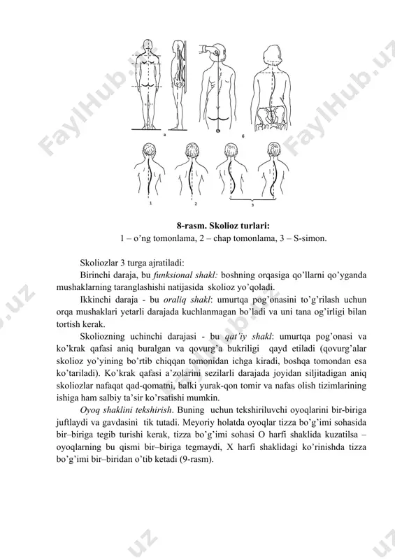 tekis (yalpoq) va yassi oyoq bo’ladi (10-rasm). oyoqning ostki sohasini kо’rikdan о’tkazganda tayanch yuzasiga, oyoq tovoni bilan oyoq ostki oldingi sohasi birikish qismi qanchalik kengayligiga e’tibor beriladi. bundan tashqari, axill pay bog’lamlarining vertikal yо’nalishdagi о’qi va yuklama tushgan holatda oyoq tovonlari sohalarining о’zgarishlari tekshiriladi. 10-rasm. oyoq kaftining tashqi kо’rinishi: а - meyoriy holatda; b - tekis; c - yassi oyoqlikning turli darajalari. shtritter metodi boʼyicha yassioyoqlikni aniqlash. kо’rikdan о’tkazganda oyoq tag sohasining izi olinadi (plantografiya). oyoq ostki sohasiga vazelin yoki biror-bir bо’yoq surtib, sо’ngra oq qog’ozga qо’yiladi, so’ng oyoq izlariga qarab yassioyoqlik holati bor-yо’qligini ham bilish mumkin. buning uchun: · oyoq izining ichki qismidagi eng chiqib turgan nuqtalarga urinma chiziq (аb) tortiladi. · аb kesmaning oʼrtasi topiladi (c). · аb kesmaning oʼrtasidan izning tashqi chekkasi bilan kesishgan joyigacha perpendikulyar (ce) oʼtkaziladi. · d nuqta – oyoq kafti izining ichki tomoni bilan perpendikulyarni kesishgan joyi va e – nuqta, perpendikulyarning izning …