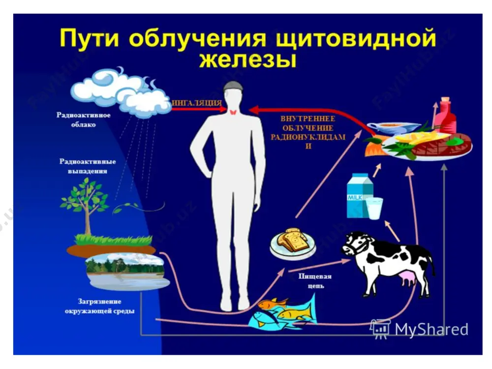 рак щитовидной железы у детей - Page 5