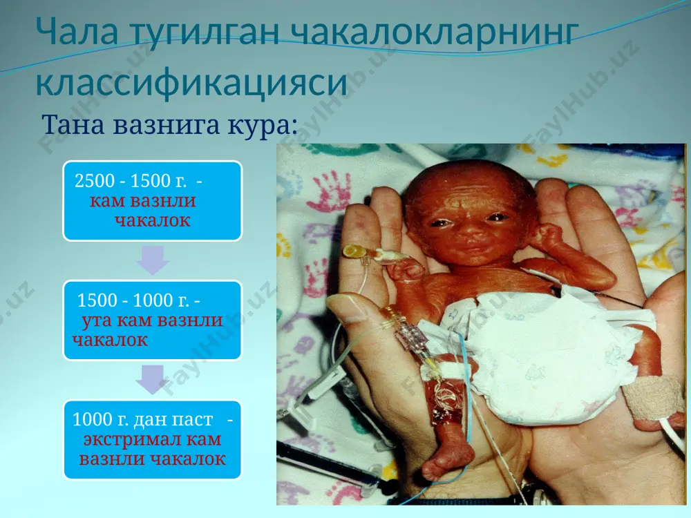 t, 2012. 2. н.п.шабалов. неонатология, санкт - петербург, 2004. 3. основы ухода за здоровым и больным новорожденным ребенком. камилов а.и., ташкент. 2007 4. решение проблем новорожденных. руководство для эффективной практики. воз 2005. кушимча адабиётлар 5. чакалоклар реанимацияси. тошкент. 2014. 6.эффективная перинатальная помощь и уход (эпу) 7. кукрак сути билан боқиш. д.и.махмудова, м.н.ахмедов, а.л.толипова ва бошқ. тошкент, м.медицина ,2003 8. внутриутробные инфекции у новорожденных.з.ж.рахманкулова, з.с.камалов, т.у.арипова ташкент ,2016 9. неонатология национальное руководство, н.н.володин, е.н.байбарин, г.н.буслаева, д.н.дегтярев. 2008.москва 10. руководство участкового педиатра т.г.авдеева, 2008, москва 11 тепловая защита новорожденного.практическое руководство (безопасное материнство), юнисеф. ташкент,2009 12. неонатология . практические рекомендации р.рооз, о.генцель-боровичени, г.прокитте.москва. медицинская литература, 2011г. 13. нормативные документы: приказы № 500,80,81,88,378,600, 226,176,74,480 интернет сайтлар 14.http://www.medicalstud.ru/med-ge 15.http://www.pharmamed.ru/rng 16.http: //www.rmj.net 17. www.mediasphera.aha.ru/ pediatr/ped-mn.htm- российский вестник перинатологии и педиатрии image3.jpeg image4.jpeg image5.png image6.jpeg image7.jpeg image8.jpeg image9.jpeg image10.jpeg image11.jpeg image12.jpeg image13.jpeg image14.jpeg image15.jpeg image16.png image17.jpeg image18.jpeg image19.jpeg image20.jpeg image21.jpeg image22.jpeg image23.jpeg image24.jpeg image25.jpeg image26.jpeg image27.png image28.jpeg …