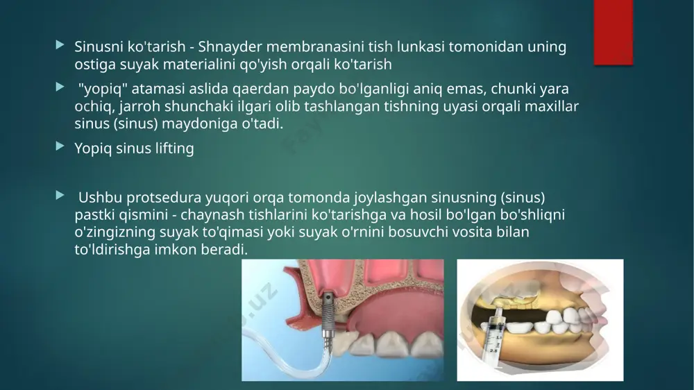 hovuz va saunalarga tashrif buyurishni istisno qilish kerak; burun bo'shlig'ida ortiqcha kuchlanish hosil qilmang-hapşırma, yo'talish va burunni kamroq puflashga harakat qiling. e’tiboringiz uchun rahmat! image6.png image7.png image8.png image9.png image10.png image11.png image12.png image13.png image14.png image2.png image3.png image4.png image5.png