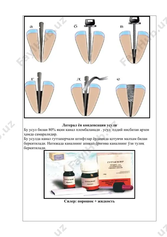 илдиз каналларини пломбалаш усуллари - Page 4
