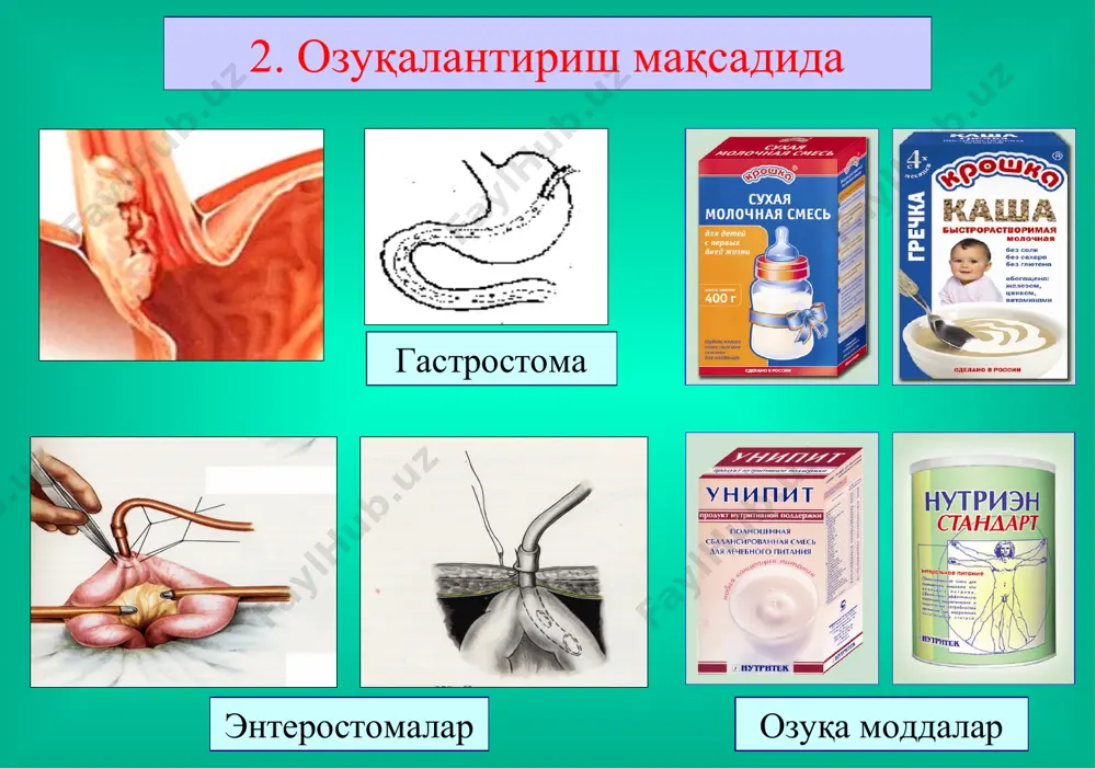 ичак оқмалари - Page 3