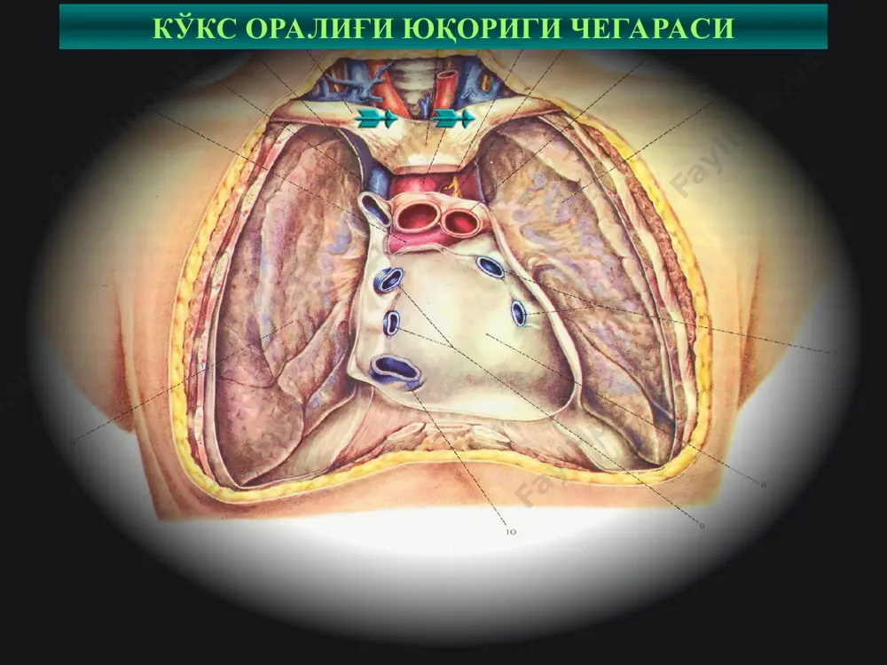 ач, трахея, йирик бронхлар, юқори ковак вена * сурункали медиастинитни даволаш консерватив терапия – туберкулезга қарши терапия, актинолизатлар ва антибиотиклар билан актиномикозни даволаш, нурли терапия, кортикостероидлар жароҳлик даво – медиастинал лимфатик тугунларни олиб ташлаш, компрессияни келтириб чиқарган битишмалар ва чандиқларни бартараф этиш * кўкс оралиғида ўсма касаллик-ларининг 100 тага яқин турлари учрайди. кўкс оралиғи чин ўсма касалликлари эмбриогенетик кўкс оралиғига хос бўлган тўқималардангина ҳосил бўлади ёки абберация натижасида шу тўқималарга хос бўлиб ривожланади. кўкс оралиғида учрайдиган ўсма касалликлар онкологик касалликлар ичида 1%ни ташкил қилади. ҳавфли ва ҳавфсиз ўсмалар 4:1 нисбатда учрайди кўкс оралиғи ўсма касалликлари кўпроқ ёш ва ўрта ёшли аҳолида учраб, эркаклар ва аёллар бирҳилда зарар-ланади. * кўкс оралиғи ўсмалари онкологик касалликлар ичида 1 % ни ташкил этади. хавфли ва хавфсиз ўсмалар 4:1 нисбатда учрайди. кўкс оралиғи ўсмалари ёш ва ўрта ёш шахсларда кўп учрайди, эркак ва аёлларда бир хил нисбатда учрайди. * кўкс оралиғи ўсмалари хавфли ўсмаларни 3-7% …