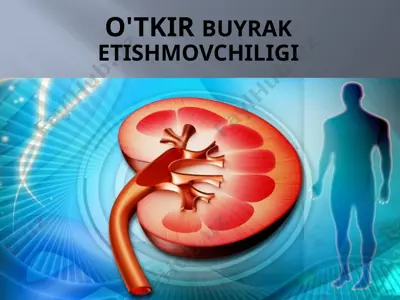 o'tkir buyrak etishmovchiligi — PPTX
