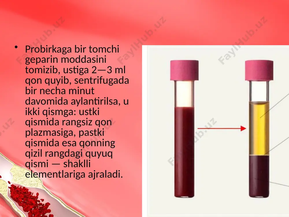 0—20 mingga yetadi va undan ham ortishi mumkin. trombotsitlar (qon plastinkalari).trombotsitlar suyaklarning ko‘mik qismida va taloqda hosil bo‘ladi. yadrosi bo‘lmaydi. past tabaqali umurtqali hayvonlar trombotsitlarining yadrosi bo‘ladi. 1 mm3 qonda 300—400 ming dona trombotsit bo‘ladi. ular leykotsitlarga o‘xshab 2—5 kun yashaydi. trombotsitlarning asosiy vazifasi qonning ivishini ta’minlashdan iborat. ular soni kamayganda qonning ivish xossasi buziladi. qonning ivishi. qonning ivishi — organizmning muhim himoya reaksiyasi hisoblanadi. qonning bu xossasi turli jarohatlanishlarda organizmni ortiqcha qon yo‘qotishdan saqlaydi. qonning ivish xossasi o‘zgarsa, ozgina jarohatlanish ham odam sog‘lig‘iga katta xavf tug‘diradi, chunki organizm ko‘p qon yo‘qotishi mumkin. sog‘lom odamda qon 3—4 minut ichida iviydi. ba’zi odamlar qon plazmasining tarkibida qonning ivishida muhim ahamiyatga ega bo‘lgan biologik modda — antigemofil omil yetarli bo‘lmaydi. bu kasallik gemofiliya deb atalib, u nasldan naslga, ya’ni ota-onadan bolaga o‘tadi. bunday odamlarda qon ivishi buziladi, natijada bexosdan burundan qon kelishi, salgina jarohat tufayli ko‘p qon yo‘qotishi mumkin. bundan tashqari, trombotsitlarning …