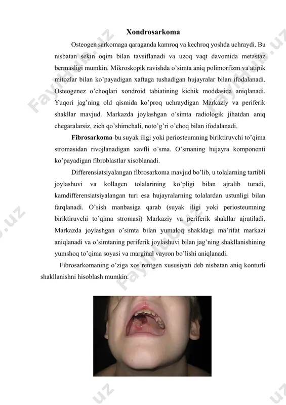 shimgichli qatlami notekis dog’li yoki burunsiz xarakterga yega. shishning keyingi rivojlanishi bilan u suyakning kortikal qatlamini yo’q qiladi, periosteum va yumshoq to’qimalarga tarqaladi. eving sarkomasi nisbatan kam uchraydigan xavfli o’smadir. bu ko’pincha o’smirlarda, asosan o’g’il bolalarda kuzatiladi. suyakning kortikal qatlamini yo’q qilib, o’simta tezda yumshoq to’qimalarga tarqaladi, ko’pincha o’pka, mediastin, buyrak usti bezlari, suyaklarga metastaz beradi. kasallikning klinik ko’rinishi to’lqinsimon tavsiflanadi, xuruj davrida og’riq kuchayadi, o’simta hajmi oshadi, shikastlangan joyda teri va shilliq qavatning giperemiyasi mavjud. ushbu davrda tananing umumiy reaksiyasi uyqusizlik, isitma va echtning oshishi shaklida aniqlanadi. o’tkir davr pasaygandan so’ng, o’simta hajmi kamayadi, lekin dastlabki hajmga yetib bormaydi, bu yesa o’simta massasining asta-sekin o’sishiga olib keladi. rentgen tekshiruvi suyak to’qimasini aniq chegaralarsiz yo’q qilishni aniqlaydi. pastki qismdan keyin kortikal qatlamni yo’q qilish bilan u bo’shashgan bo’ylama chiziqlar hosil qilib, xarakterli naqshga yega bo’lishi mumkin. foydalaniladigan adabiyotlar: 1. m.n. muminova, m.a. maksumova «kasbiy etika va etiket», uslubiy qo’llanma, t.,2006. …