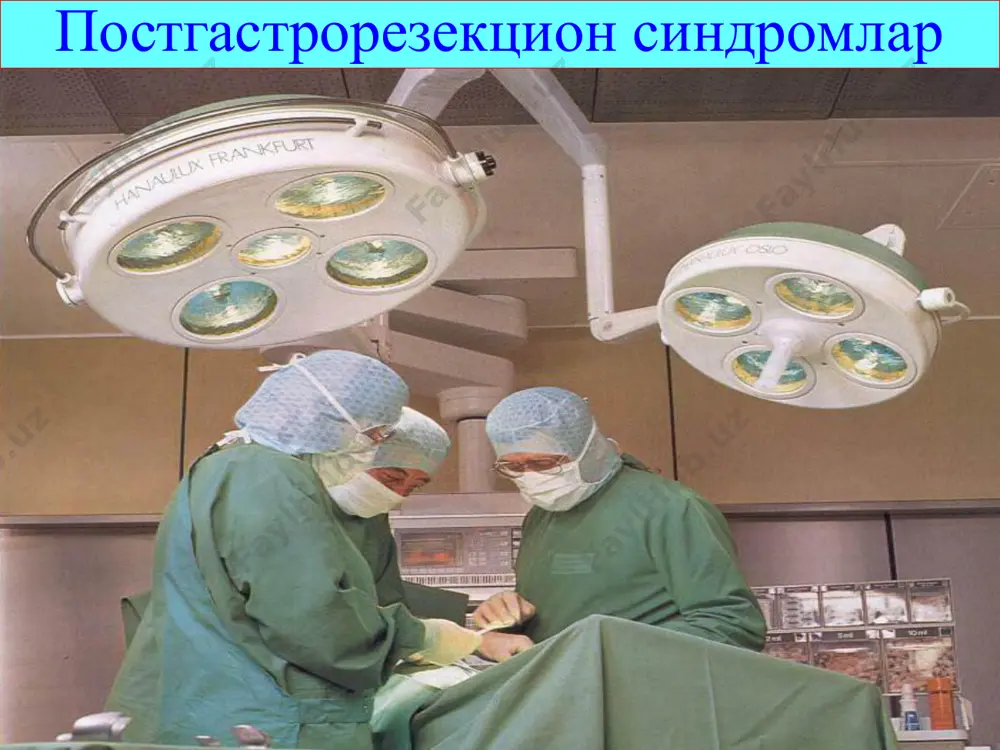 vqatlanishdan qo'rqish hissiyoti, holsizlik, qo'lansa hidli kekirish ............... + v12 defitsit anemiya ... ... ... klinik belgilari: keltiruvchi qovuzloq stenozi (torayishi) demping sindromi ozuqaning birdaniga olib ketuvchi qovuzloqqa tushishi, uning osmotik bosimining yuqoriligi (3000-4000 mosm), ichak devoriga qon oqimini kuchayishi va plazmadan suyuqlikni ichak ichiga o'tishi, ozuqaning bijg'ish jarayonining kuchayishi ............. qonning qayta taqsimlanishi, kol-laps yoki shok belgilari (hushdan ketib yiqilishgacha), taxikardiya, gipotenziya, holsizlik, ozib ketish, v12 defitsit anemiya, teri rangpar-ligi, ovqatlanishdan qo'rqish, qayt qilish ......................... demping sindromi belgilari: qon – tomir va neyrovegetativ belgilar: holsizlik xuruji, taxikardiya, isib ketish yuzi va barmoqlarini rangparligi, panja va barmoqlarning titrashi, bosh aylanishi, ko'z oldi qorong'ilashishi, sovuq ter ajralishi. dispeptik va abdominal diskamfort: ishtahaning yo'qligi, ko'ngil aynish, qayt qilish, qorindagi g'uldirash, suyuq beix-tiyor ich ketishi yoki qabziyat. metabolik tizimning buzilishi bilan bog'liq belgilar: ozib ketish, ovqat hazm qilish etishmovchiligiga xos shikoyatlar. gepato pankreatoduodenal sistema yallig'lanish kasalliklari-ga xos belgilar: duodenostaz va qorin bo'shlig'i chandiqli …