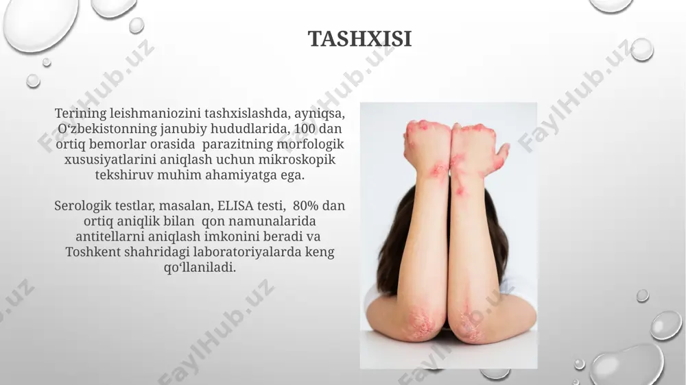 leyshmaniozning teri shakli - Page 4