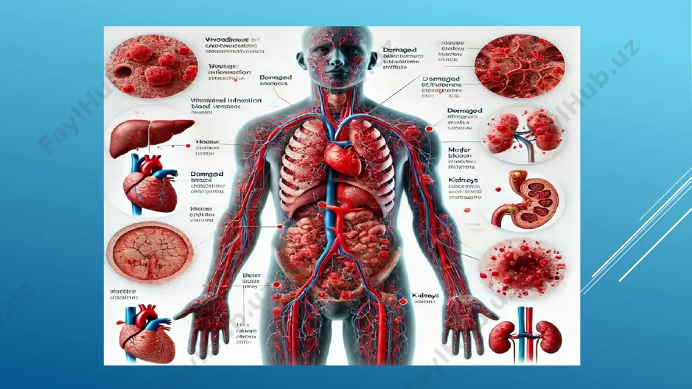sepsis - Page 3