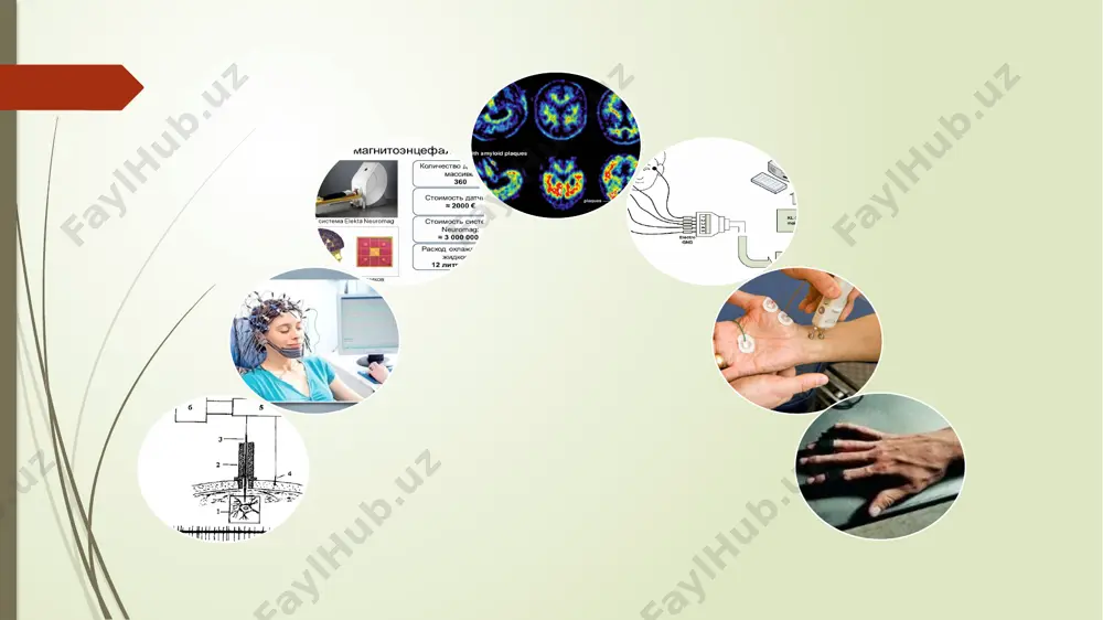 apparatlari 8-24, baʼzan 32 kanalli boʻlib, klinik diagnostikada 8 yoki 16 kanalligidan foydalaniladi; tekshiruv oʻtkaziladigan xona yorugʻ va tovushdan himoyalangan, tekshiruvchi yoki bemorga hech qanday taʼsirotlar halal bermaydigan boʻlishi kerak. shuningdek, uni bemorga (mijozga) mutlaqo bezarar va ogʻriqsiz ekanligi ham tushuntirilishi lozim. maʼlumki bosh miya biopotensiallari juda kichik, shu bois uni yozib olishda kuchli elektron kuchaytirgich (usilitel) zarur boʻladi. elektroensefalografiyani monopolyar va biopolyar usullarda yozish hamda uni xohlagan kombinatsiyada amalga oshirish mumkin. elektroensefalografiya jarayonida turli funksional qoʻzgʻotish usullarini qoʻllash mumkin, bu sunʼiy qoʻzgʻotish bosh miyani faollashtirib, ayrim yuzaga chiqmayotgan "toʻlqinlarni" jonlantiradi, bu "chaqirilgan" elektrotoʻlqinlar orqali tegishli kasallikni aniqlasa boʻladi. elektroensefalografiya yozish paytida bemorni yoshi, umumiy ahvoli hamda kasallikning kelib chiqishi va boshqa koʻpgina holatlarga ahamiyat berish lozim. elektroensefalografiya shifokorga muhim maʼlumot berishiga qaramay, uni barcha klinik tekshirishlarga qoʻshimcha diagnostika usuli deb qarash mumkin. bosh terisi yuzasidan ajratilgan miya neyronlarining umumiy elektr faolligini qayd etishga asoslangan yozuv – elektroensefalogram (eeg) deyiladi. …