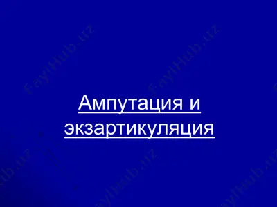 ампутация и экзартикуляция — PPTX