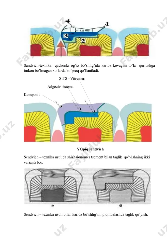 sendvich-texnika - Page 3