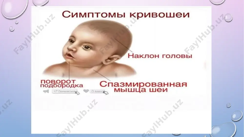 детский массаж при кривошее - Page 5