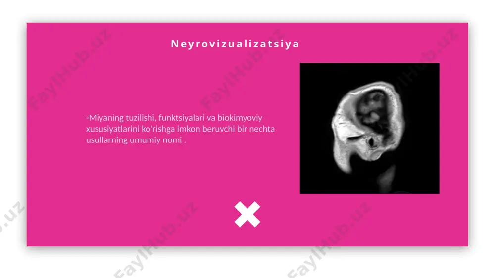 arni, shuningdek, notekis tizimning ba'zi nuanslarini aniqlashingiz mumkin. shuningdek, mri yordamida siz miya yarim korteksining faollashuvini kuzatishingiz mumkin. boshqacha aytganda, ushbu tadqiqotning imkoniyatlari katta. flat themes altsgeymer altsgeymer kasalligi progressiv demans shaklining nomidir. kasallikning rivojlanishi katta yoshdagi (60-65 yosh) bemorlarda kognitiv funktsiyalarning bosqichma-bosqich yo'qolishiga olib keladi. keksa demans bilan og'rigan odamlarda xotira yo'qolishi, e'tiborning pasayishi, nutq, fazoviy orientatsiya va asosiy fikrlash qobiliyatlari yo'qoladi. altsgeymer altsgeymer kasalligining patogenezi tibbiyot hamjamiyatida munozarali mavzu bo'lib qolmoqda. uzoq muddatli tadqiqotlar atrof-muhit va keksa demansning rivojlanish ehtimoli o'rtasidagi bog'liqlikni aniqlamadi. patologiya beta-amiloid to'planishining shakllanishi fonida rivojlanadi - ular keksa plaklar deb ataladi. beta-amiloid miqdorining oshishi neyronlarning o'limiga olib keladi. flat themes raahmaat! image3.gif image4.gif image5.png image6.gif image7.jpg image8.gif image9.jpg image10.gif image11.jpg image12.gif image13.jpeg image14.jpg image15.jpg image16.jpg image17.gif image18.jpg image19.jpg image20.gif image21.gif /docprops/thumbnail.jpeg