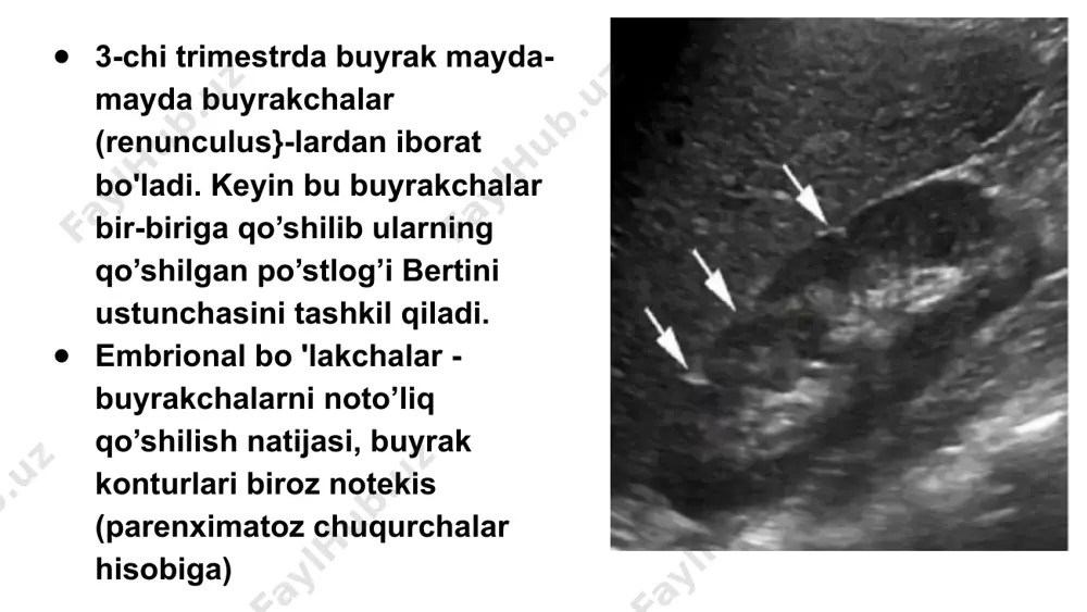 buyrak kasalliklarida ultratovush tekshiruvi - Page 4
