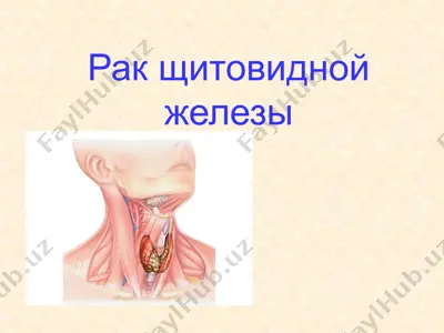 рак щитовидной железы — PPTX