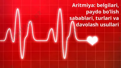 aritmiya - belgilari, paydo bo'lish sabablari, turlari va davolash usullari — PPTX