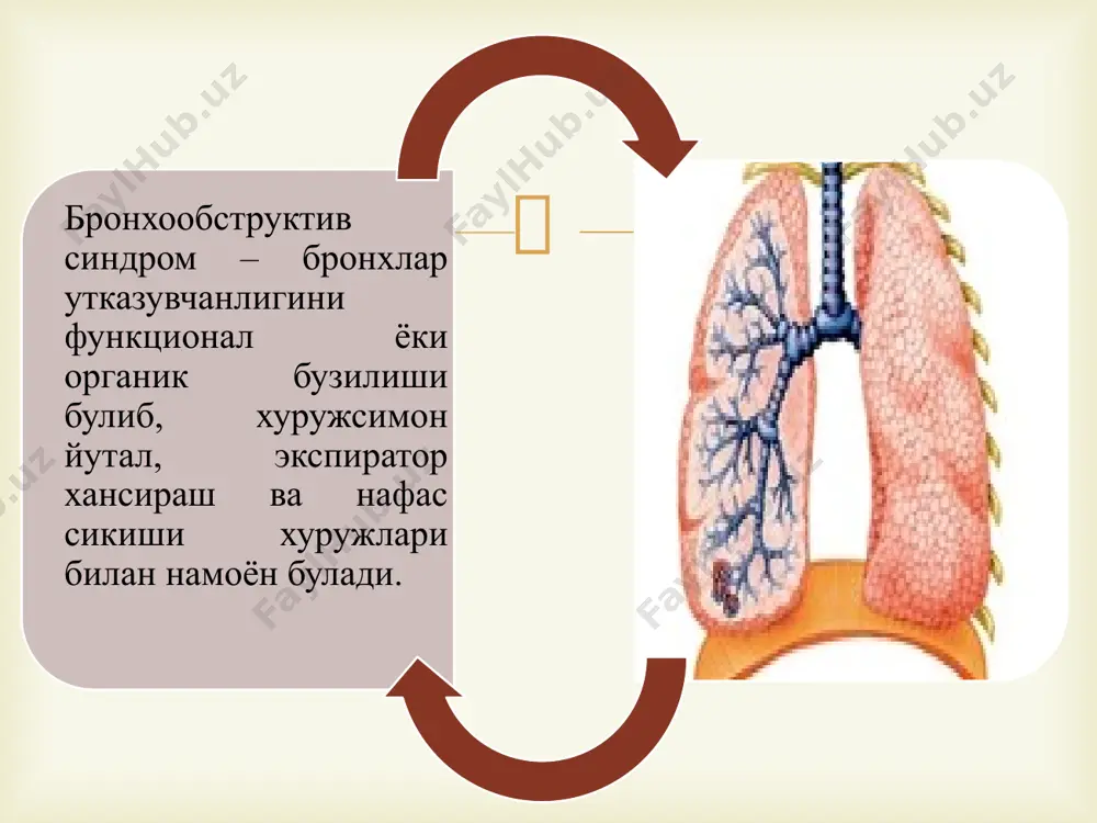 бронхообструктив синдромқиесий ташхиси.уаш тактикаси. - Page 4