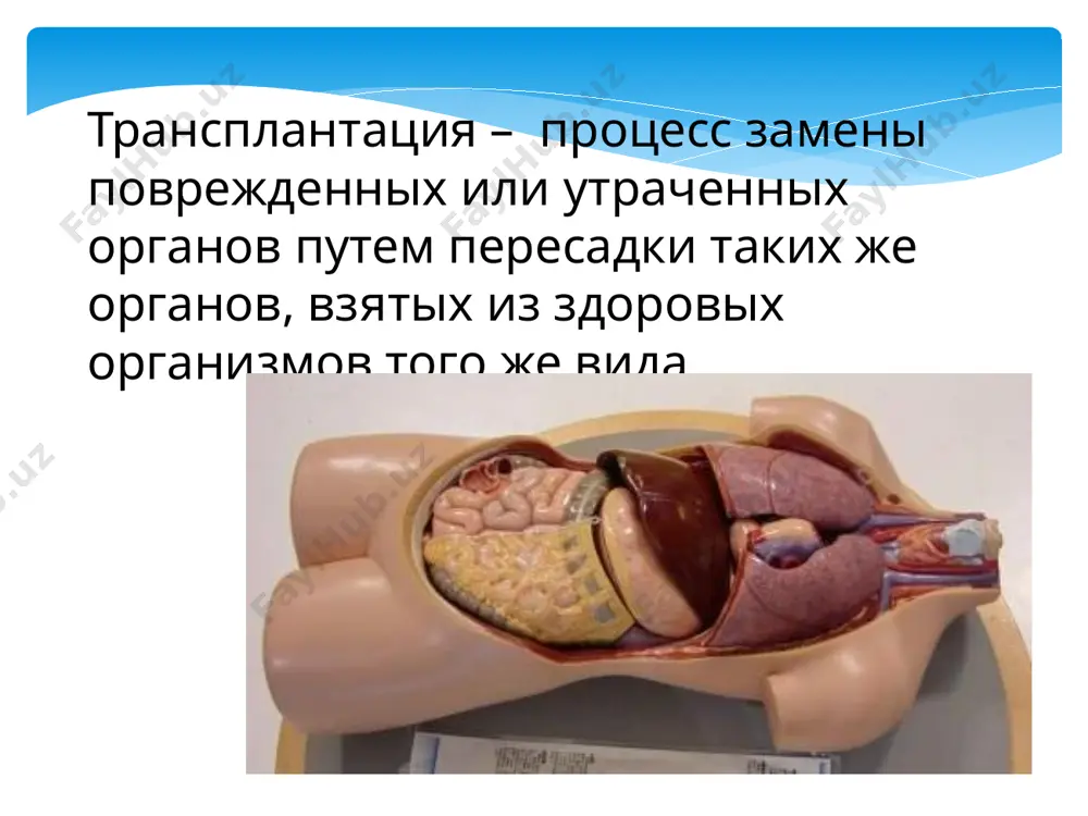 отторжения пересаженных клеток и тканей имеет 2 фазы. - 1 фаза вокруг трансплантата и сосудов наблюдается скопление иммунокомпетентных клеток(лимфоидная инфильтрация),в том числе т-киллеров - 2 фаза происходит деструкция клеток трансплантата т-киллерами,активируеться макрофагальное звено,естественные киллеры,специфический антителогенез.возникает иммунное воспаление,тромбоз кровеносных сосудов,нарушается питание трансплантата и происходит его гибель.разрушенные ткани утилизируются фагоцитами. в процессе реакции отторжения формируються клон т- и в- клеток иммуной памяти.повторная попытка пересадки тех же органов и тканей вызывает вторичный иммунный ответ,который заканчивается отторжением . трансплантационный иммунитет с клинической точки зрения выделяют острое,сверхострое,отсроченное отторжения трансплантата. - острое отторжение – это реакция иммунной системы по механизму первичного ответы,которая развивается в течении первых недель или месяцев после трансплантата в отсутствии иммуносупрессивной терапии . в ее основе лежит комплекс всевозможных цитологических реакций(активация комплемента иммунными комплексами) и антителозависимые - отсроченное отторжение – имеет тот же механизм,что и острое.возникает через несколько лет после операции у пациентов,получившие иммуносупрессивную терапию. - сверхострое отторжение или криз отторжения ,развивается в …