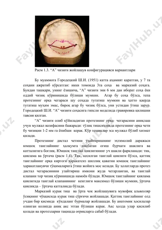 и тилчага ўхшаш бирмунча юқорилаган бўртиқ билан якунланади. “а” чизиғи топографияси борасида турли фикрлар мавжуд. свенсон с. (1964), бетельман а.и. (1965), ли т. (1975) фикрига кўра, чизиқ танглайни альвеоляр дўнгликлар ва танглай чуқурчалари орқасидан кесиб ўтади. 40 йиллик тажрибамиз натижасида биз шундай тўхтамга келдикки, “а” чизиғи конфигурацияси қаттиқ танглай суяк асосининг шаклидан келиб чиққан ҳолда ўзгариши мумкиндир. демак, “а” чизиғи қаттиқ танглай олд томонга 2 см га силжиши, юқори жағ дўмбоклари асоси нисбатидаги чизиқ бўйлаб жойлашиши, ёки юмшоқ танглай ва ҳалқумтомонга 2 см гача силжиши мумкин (расм 1.3). расм 1.3. “а” чизиғи жойлашув конфигурацияси вариантлари бу муаммога городецкий ш.и. (1951) катта аҳамият қаратган, у 7 та соҳани ажратиб кўрсатган: икки томонда 3та соҳа ва марказий соҳага. бундан ташқари, унинг ёзишича, “а” чизиғи эни 6 мм дан иборат соҳа ёки оддий чизиқ кўринишида бўлиши мумкин. агар бу соҳа бўлса, тепа протезнинг орқа чегараси шу соҳада тугатиш мумкин ва ҳатто қаерда тугатиш …
