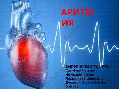 aritmiya — PPT