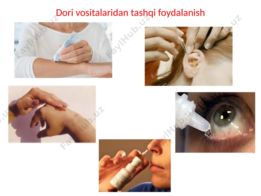 'rtacha 30 minutga erishiladi. jarayonni o'tkazish : 1. bemorni qulay pozitsiyani olish va kiyimlardan in'ektsiya joyini bo’shatishni taklif qiling (agar kerak bo'lsa, bu bemorga yordam bering). 2. qo'llarni issiq suvda sovun bilan yaxshilab yuving; sochiq bilan artib bo'lmasdan, nisbiy bepushtlikka olib kelmaslik uchun qo'llarni spirtli ichimliklar bilan mahkamlang; steril qo'lqoplarni qo'ying va ularni steril paxta to'pi bilan to'plang, namlangan 70% spirtli eritmada namlanadi. 3. dori-darmonni tayyorlang. 4. inyeksiya joyini 70% spirtli eritmada, bir yo'nalishda namlangan ikkita sterlolli eritma bilan ishlaydi, bir yo'nalishda: birinchi katta zona, keyin ikkinchi to'pni to'g'ridan-to'g'ri in'ektsiya joyi. 5. shpritsdan qolgan havo pufakchalarini olib tashlang, ignali va boshqa barmoqlar bilan silindrni o'ng tomonga olib boring va katta va boshqa barmoqlar bilan silindrni o'ng tomonga oling. 6. in'ektsiya joyida terini shakllantirish uchun chap qo'lning katta va indeks barmoqlarini teriga shakllantiring. 7. harakatning 30-45 ° burchakli burchak ostida 1-45 ° gacha bo'lgan burchak ostida 15 mm chuqurlikka kiring; shu …