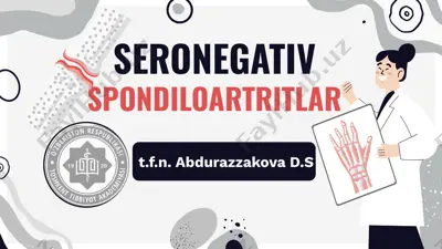 seronegativ spondiloartritlar — PPTX