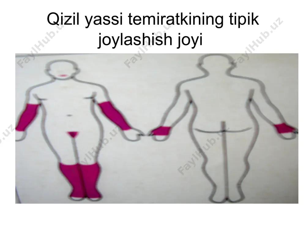 qizil yassi temiratki - Page 5