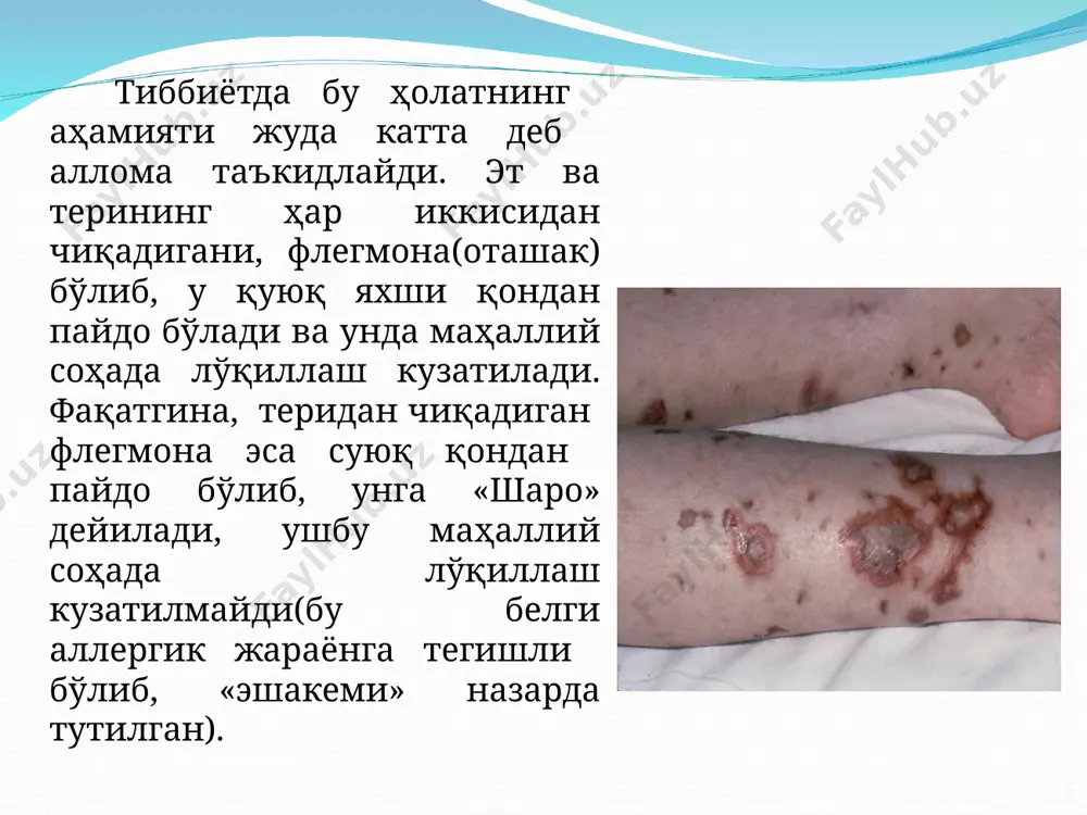 йирингли жаррохликда ибн сино кушган хиссаси - Page 5