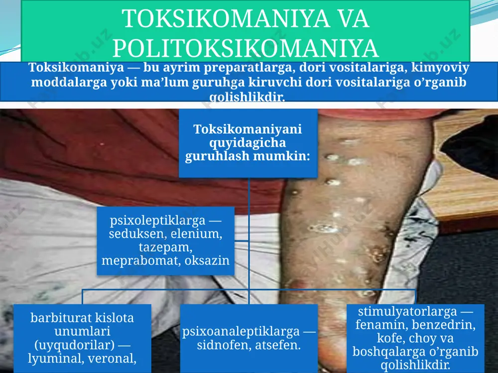 ik yordam ko’rsatish tizimi faoliyatini tartibga solish jarayonlarini muvofiqlashtirish, nazorat qilish va qonuniy ta’minlash. “fuqarolar sog’ligini muhofaza qilish to’g’risida”gi qonun o’zbekiston respublikasining “fuqarolar sog’ligini muhofaza qilish to’g’risida”gi qonunining 34-moddasiga muvofiq, giyohvandlik va toksikomaniya bilan kasallangan bemorlarni davolash uchun o’zbekiston respublikasi sog’liqni saqlash vazirligi tomonidan ruxsat berilgan vositalar va usullardan foydalaniladi. “narkologik bemorlarga tashxis qo’yish, davolash va tibbiy-ijtimoiy reabilitatsiya standartlari”da mustahkamlab qo’yilgan. ogoh bo`ling-sog’ yashaysiz! e’tiboringiz uchun tashakkur image3.jpeg image5.jpeg image6.jpeg image7.wmf image8.jpeg image9.png image10.jpeg image11.jpeg /docprops/thumbnail.jpeg