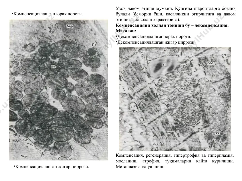 ишига, хужайраларни пролифератив фаоллигига, патологик жараён характерига боғлиқ. регенерацияни таснифи: физиологик регенерация реператив ёки тикланиш регенерация патологик регенерация реператив тикланиш ҳужайра ва тўқимани шикастлантирувчи хар хил патологик жараёнларда таъсир оқибатида кузатилади. тўлиқсиз ва тўлиқ турлари тафовут қилинади. патологик регенерация қуйидаги ҳолларда кузатилади. айнаган регенератор жараён пролиферация ва табақаланиш фазаларини ўрин алмашинувини бузилиши. гипер ёки гипорегенерация метаплазия кузатилади. алохида аъзо ва тўқималарни регенерацияси қонни регенерацияси физиологик регенерация интенсивлиги билан фарқланади экстрамедуляр қон яратиш ўчоқлари пайдо бўлади ёғли кўмикни миелоидли метаплазия кузатилади қонни патологик регенерацияси қон яратиш издан чиқиши ва айнаши функционал етилмаган тўла қийматли бўлмаган ва тез парчаланиб кетадиган қон элементлари хосил бўлади. кўмик жуда юқори пластик хусусиятига эга ва шикастланганда тўлиқ тикланади. лимфатик тугунлар регенерацияси олиб келувчи ва олиб кетувчи томирлар ва атрофидаги бириктирувчи тўқима билан сақланиб қолганда кузатилади. қон томирлар регенерацияси уларни калибрасига боғлиқ (диаметрига). майда томирлар 2 йўл билан регенерацияланади: куртакланиш ва аутоген йўл билан. йирик томирларда хар …
