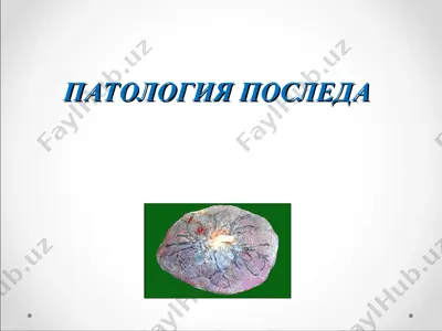патология последа — PPT