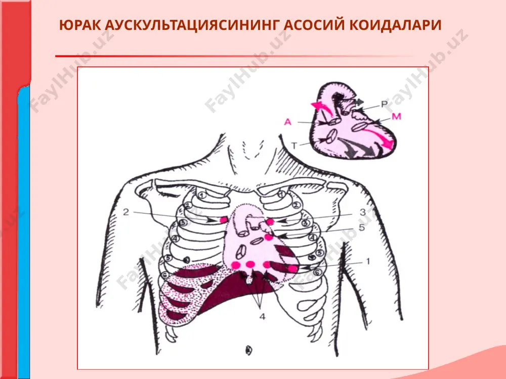 metallik tonlar) xosil bulishi - kachonki yurakga yakin joylashgan upka tukimasida katta bushlik xosil bulishida (upka abstsessidan keyin – kaverna xosil bulishi eki, pnevmotoraks). yurak tonlari yurak omillari yurak faoliyatining jismoniy xarakatda kuchayishi. kuchaygan yurak faoliyati isitmada, yakkol ifodalangan anemiyada,, nerv-ruxiy kuzgalishda, tireotoksikozda, taxikardiya xuruji paytida kuzatiladi 2. yurakni ikkala tonini susayishi: yurak tonlarini susayishi xamda anikligini pasayishi – bugiklashgan ton deyiladi, tonlarning keskin sustlashishi esa - bugik ton deyiladi. yurakdan tashkari bulgan omillar: juda kalin yoki shishgan kukrak devori, katta sut bezlari. plevral bushlikka yoki perikardga suyuklik tulishi. upka emfizemasi. yurak tonlari yurak omillari: yurak mushaklarining utkir va surunkali kasalliklarida,(kiskarish faoliyatining payishi): miokarditlarda, miokard distrofiyalarida, kardiosklerozda, kollaps, perikard bushligida suyuklik bulganda. masalan miokard infarktida, yurak nuksonlarida yurakning dekompensatsiyasi, periferik kon aylanishining utkir etishmovchiligi. diagnostik nuktai nazardan tonlardan birini uzgarishi axamyatlirokdir, chunki bunday uzgarishlar aynan yurak xastaliklarida kuzatiladi. yurak tonlari 3. yurak chukkisida va tush suyagining xanjarsimon usigi asosida 1-tonning …