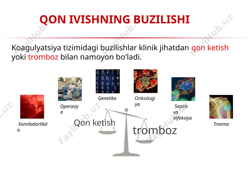 lag time - aktivator qo'shimchasi bilan plazma akontaktda bo`lgandan keyin tomb shakllanishining boshlanishi uchun ketgan vaqt. koagulyatsiyaning boshlang'ich bosqichini tavsiflaydi. warfarin uchun eng sezgir parametr gipokoagulyasiya: v kamayadi tlag uzayadi giperkoagulyasiya: v oshadi og'ir holatlarda spontan tromblar shakllanishi qayd etiladi v (mkm/ min)- параметр. tromb o'sish tezligi. koagulyatsiyaning tarqalish fazasini xarakterlaydi. geparinga ko` ko`proq sezgir parametrdir. tsp [min]-spontantromblar paydo bo'lishi plazmaning o'z prokoagulyant potentsialining sezilarli darajada oshishini ko'rsatadi. d [усл. ед.], tromb zichligi(grafikda tasvirlangan). hosil bo'lgan fibrin trombining zichligini va uning tuzilishini xarakterlaydi. xiii omil faolligi bilan birgalikda fibrinogen kontsentratsiyasiga bog'liq. test parametrlari blank xisoboti blank saqlaydi: bemor ma`lumotlari trombodinamika parametrlari natijalari (v, tlag, d va. b) diapazon normalari график размера сгустка от времени tromb o`lchamining vaqtlar bo`yicha grafigi fibrinli trombning shakllanishining 5, 10, 15 – daqiqalardagi rasmlari laboratoriya xizmatining trombodinamika testi bo`yicha xulosasi kimlar foydalanadi testdan? biz davolovchi shifokorga bemorning qon ivish tizimining holatini aniq va ishonchli baholashni ta'minlaymiz …