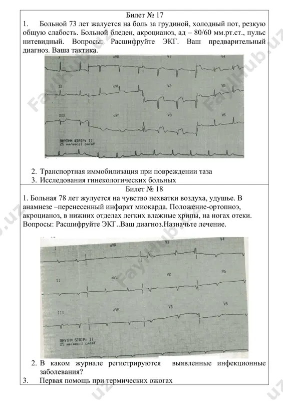 дика и техника пальпации щитовидной железы амбулаторная 2. помощь при кровотечениях из пищевода и желудка 3.пошаговые практические навыки при осмотре больного с пав и определение психического статуса билет № 32 1. методика определения индекса массы тела (индекс кетле) и степени ожирения. 1. проведение венозных проб 1. измерение женского таза билет № 33 1. расчет суточной дозы инсулина 2.техника установки зонда блекмора 4. 3. пошаговые практические навыки при купировании абстинентного синдрома билет № 34 1. исследование координации движений 2.проведение плевральной пункции 3.взятие мазка из 3-х точек билет № 35 1.исследование чувствительной сферы 2. пальпация молочной железы 3. расскажите технику проведения бимануального (двуручного) исследования гинекологических больных билет № 36 1. методика и техника пальпации щитовидной железы амбулаторная 2.исследование функции глазодвигательных нервов 3. измерение женского таза билет № 37 1. исследование функции тройничного нерва 2. больному с острым инфарктом миокарда снята экг. вопросы: расшифруйте экг. диагноз. лечение. 3. осмотр шейки матки в зеркалах …