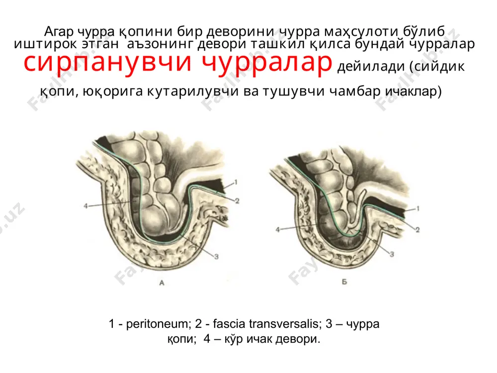 ist3 diagramma2 paxovie bedrennie pupochnie beloy linii posleperatsionnie 0.75 0.08 0.04 0.01 0.12 list1 vozrast do 1 goda 2 4 8 10 15 20 25 30 35 40 45 50 60 65 70 75 chastota 14 8 6 2 1 1 2 2 7 18 25 20 5 6 24 26 28 paxovie bedrennie pupochnie beloy linii posleperatsionnie 75% 8% 4% 1% 12% list1 14 8 6 2 1 1 2 2 7 18 25 20 5 6 24 26 28 chastota list2 paxovie bedrennie pupochnie beloy linii posleperatsionnie 0.75 0.08 0.04 0.01 0.12 list3 0 5 10 15 20 25 30 0% 20% 40% 60% 80% paxoviebedrenniepupochniebeloy linii posleperatsionnie r1