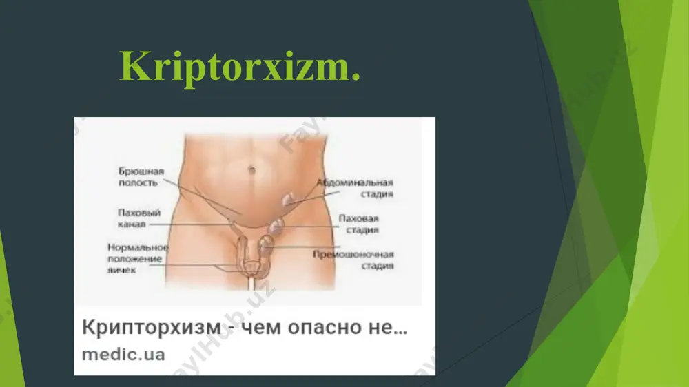 kriptorxizm. etiopatogenezi, klinikasi, diagnostikasi, davolash - Page 3