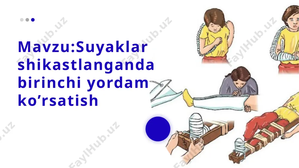 odam yiqilganida yoki biron jarohat olganida sinishi mumkin. ayniqsa, qo‘l va oyoq suyaklari ko‘proq sinadi. suyaklar yopiq va ochiq sinishi mumkin. yopiq singan suyak tashqi ko'rinishi bilan sog‘lom suyaklardan deyarli farq qilmaydi, faqat kuchli og‘riq suyakning singanligidan darak beradi bunday hollarda, birinchi navbatda, suyakning singan joyining harakatsizligi ta’minlanishi lozim. suyaklar joyidan qo‘zg‘almasligi uchun singan joyga taxtakach qo‘yib bog‘lanadi. tayyor taxtakach bo‘lmaganida taxta, daraxt novdasi yoki kartondan taxtakach yasaladi. shikastlangan joy ezilmasligi uchun taxtakach ostiga yumshoq narsa qo‘y'ladi. taxtakach bint bilan qo‘l yoki oyoqqa bog‘lab qo‘yiladi. buning ham iloji bo‘lmaganda singan qo‘l tanaga, singan oyoq sog‘lom oyoqqa bog‘lab qo‘yiladi. bunday chora og‘riqni kamaytirish bilan birga singan suyaklarning joyidan siljib, boshqa organlarning jarohatlanishidan saqlaydi suyaklarning ochiq sinishi ayniqsa xavfli hisoblanadi. ochiq singan suyak g'ayritabiiy shaklga kiradi. odatda, oyoq yoki qo‘l suyaklari ochiq sinadi. bunday hollarda singan suyakni mutlaqo harakatlantirmaslik lozim. aks holda, suyakning singan qirralari muskullar, qon tomirlari, nerv to‘qimalan va teriga …