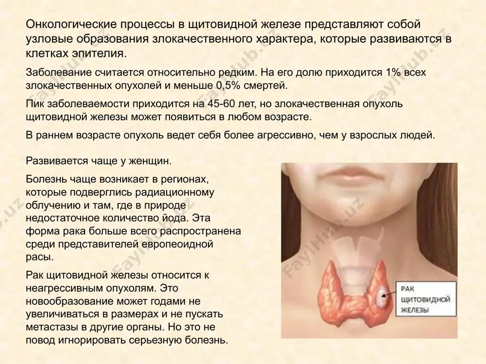 ующим облучением у медицинского персонала, у рабочих в горячих цехах или деятельность, связанная с тяжелыми металлами. стрессовые ситуации. сильные стрессы, после которых человек долго не может прийти в себя и депрессии подрывают иммунитет. а ведь именно иммунные клетки отвечают за уничтожение раковой опухоли. вредные привычки. табачный дым содержит канцерогенные вещества, а алкоголь ослабляет естественную защиту организма против нетипичных клеток. также могут способствовать хронические болезни: заболевания женских половых органов. хронические болезни матки и яичников, особенно если они сопровождаются гормональным нарушением. опухоли молочных желез. доброкачественные и злокачественные новообразования в груди у женщин (особенно гормонозависимые). полипы прямой кишки и рак толстого кишечника. многоузловой зоб. доброкачественные опухоли и узелки щитовидной железы. виды рака щж папиллярный рак щитовидной железы такие раковые опухоли имеют на своей поверхности множество выступов, напоминающих сосочки. из-за этого новообразование становится похоже на лист папоротника. папиллярный рак относится к высокодифференцированным опухолям. это значит, что его клетки на первый взгляд похожи на нормальные …