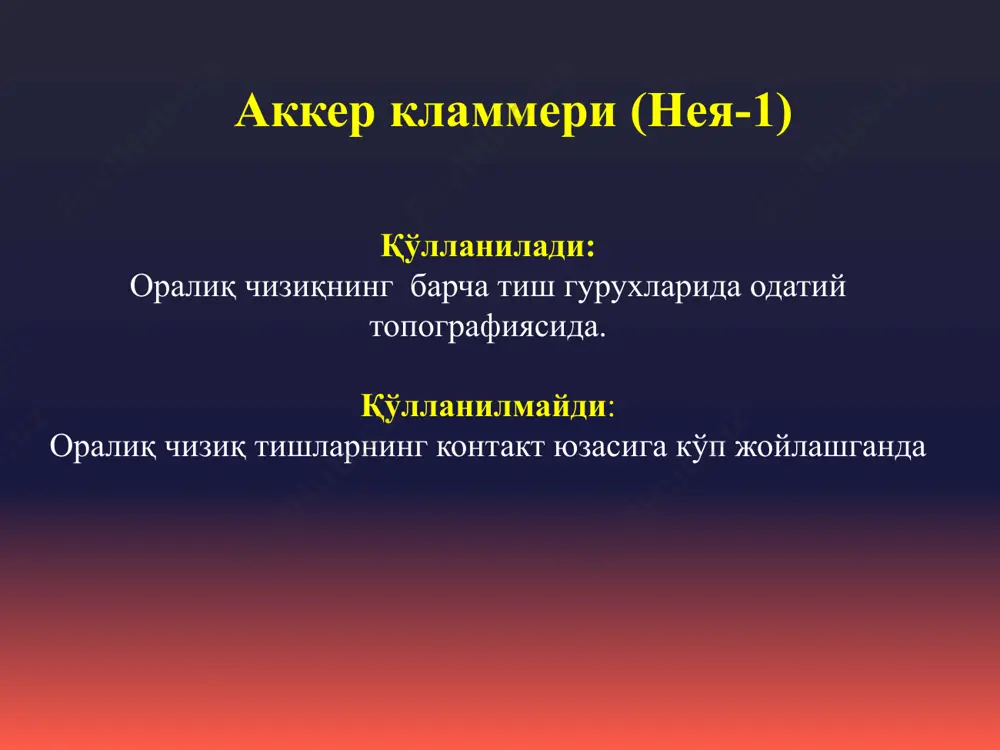 нея «ney» системаси бўйича кламмерлар - Page 4