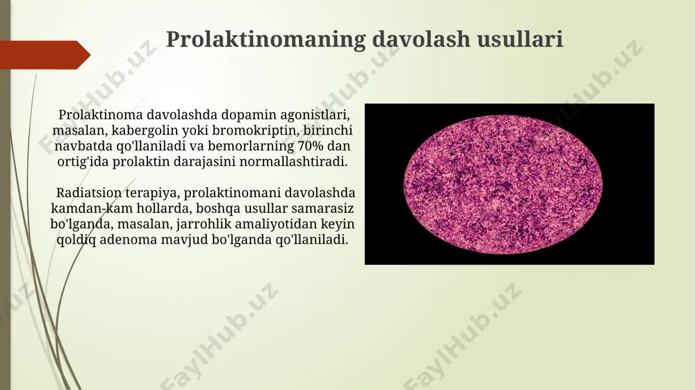 atuv va davolashni talab qiladi. e'tiboringiz uchun rahmat @taqdimot_robot image1.jpg image2.jpg image3.jpg image4.jpg image5.jpg image6.jpg image7.jpg image8.jpg image9.jpg image10.jpg image11.jpg image12.jpg image13.jpg image14.jpg image15.jpg
