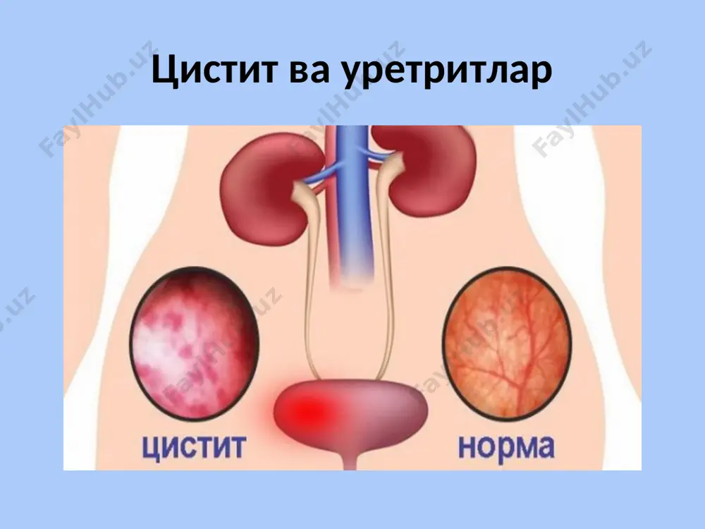 уретрит ва циститлар - Page 3