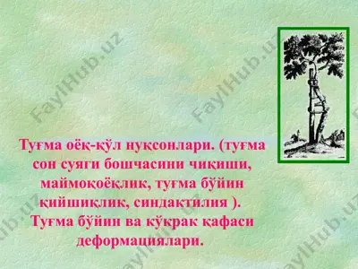 туғма оёқ-қўл нуқсонлари — PPT