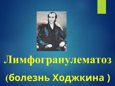 лимфогранулематоз (болезнь ходжкина) — PPT