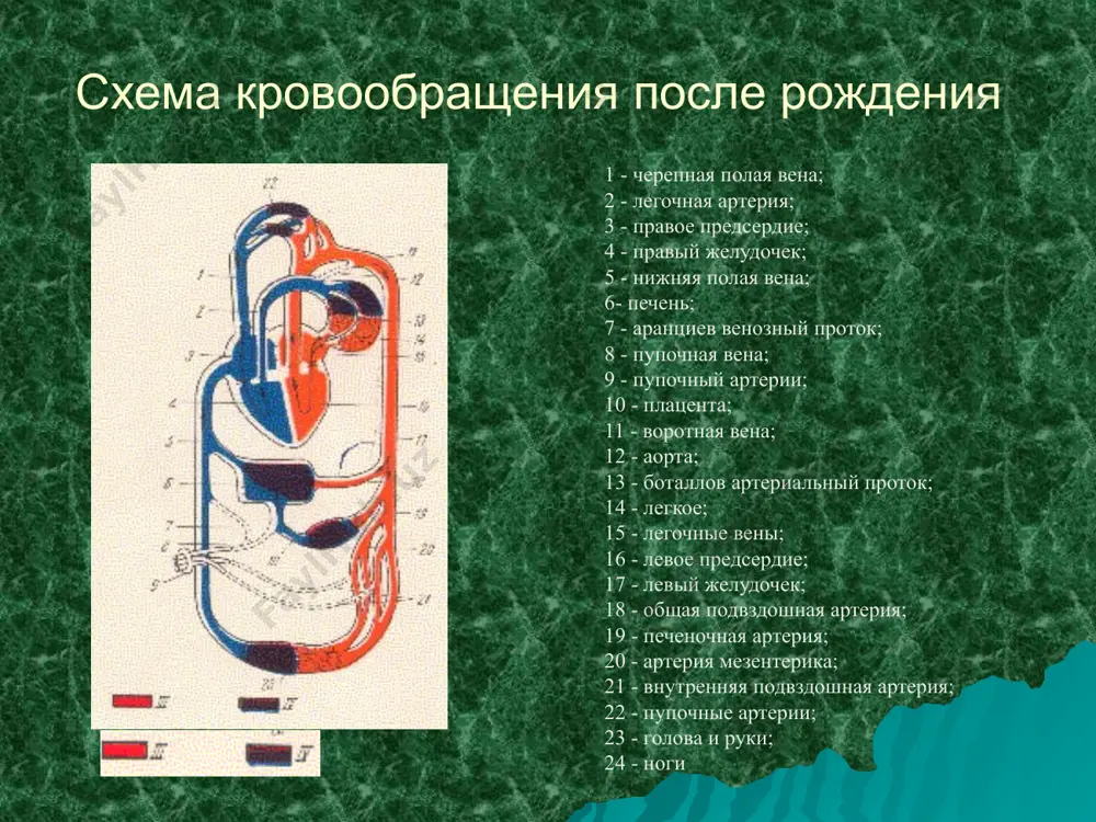 малый круг поступает недостаточное количество крови (стеноз легочной артерии) - а в большой круг через дмжп и аорту сбрасывается венозная кровь - границы сердца в норме или увеличены значительно - вдоль левого края грудины выслушивается грубый систолический шум - ii тон на легочной артерии ослаблен рентген: сосудистый рисунок обеднен, сердце часто в форме сапожка, с выраженной талией и приподнятой верхушкой - цианоз - гипоксемические приступы -”барабанные палочки” -систолич. ад -снижено -отставание в физ развитии комплекс эйзенменгера повышение давления в легких, склерозирование сосудов шунт справа- влево цианоз транспозиция магистральных сосудов - с 1 месяцев жизни сердечная недостаточность -акцент 2 тона на легочной артерии -гипретрофия правого желудочка усиление легочного рисунка врожденные пороки с обеднением большого круга кровообращения коарктация аорты гемодинамика: 1. в связи с сужением аорты повышается нагрузка на левый желудочек, что приводит к его перегрузке. 2. выше места сужения имеется гипертензия 3. вследствие этого сосуды головы, плечевого пояса и верхних конечностей …