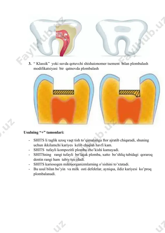 sendvich-texnika - Page 5