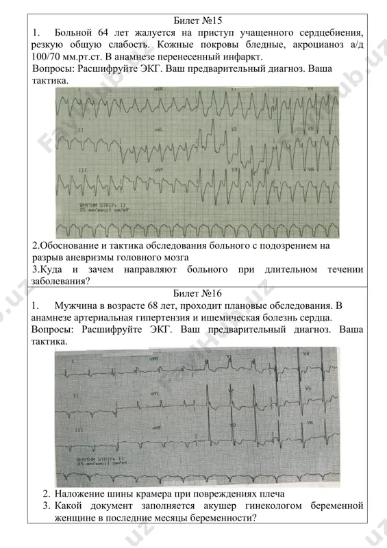 жалуется на сердцебиение, чувство замирания сердца, небольшую одышку при физической нагрузке. в анамнезе- гипертоническая болезнь в течение 5-6 лет. 1. расшифруйте экг. диагноз. какие антиаритмические препараты вы рекомендуете? 2. транспортная иммобилизация при повреждении бедра, наложение лестничных шин 3. как называется ф-025-3-/у- и кем заполняется ? билет № 23 1. больная 67 лет госпитализирована в связи с участившимися приступами стенокардии. за сутки принимает 8-10 таблеток нитроглицерина. вопросы: расшифруйте экг. ваш диагноз. назначьте лечение. 2. определение резус-фактора 3. как называется ф-025-1-/у и кем заполняется ? билет № 24 1. 1. больная 72 лет страдает гипертонической болезнью, жалуется на периодические повышения ад до 170/100 – 180/100 мм рт.ст., головные боли, головокружения. снята экг. 2. вопросы: расшифруйте экг. ваш диагноз. лечебная тактика. 2.первая медицинская помощь при повреждении шеи и предрлечья. 3. как называется ф-029-/у и кем заполняется ? билет № 25 1. больному с острым инфарктом миокарда снята экг. вопросы: расшифруйте экг. диагноз. лечение. …